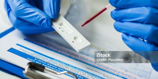 istockphoto-1285146486-1024×1024 Lab scientist performing rapid diagnostic test for antibodies to detect presence of viral protein antigens expressed by COVID-19 corona virus disease, CDC quick fast antibody point of care testing