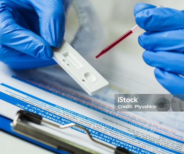 Lab scientist performing rapid diagnostic test for antibodies to detect presence of viral protein antigens expressed by COVID-19 corona virus disease, CDC quick fast antibody point of care testing