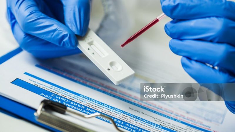 Lab scientist performing rapid diagnostic test for antibodies to detect presence of viral protein antigens expressed by COVID-19 corona virus disease, CDC quick fast antibody point of care testing